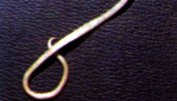 Sukabumi Toddler's Death Confirmed as Roundworm Infection, Says Health Ministry