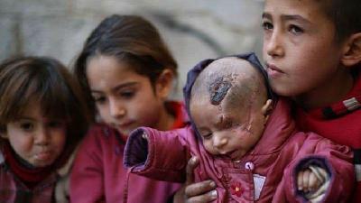 Foto Derita Karim, Bayi asal Suriah, Bangun Solidaritas Dunia