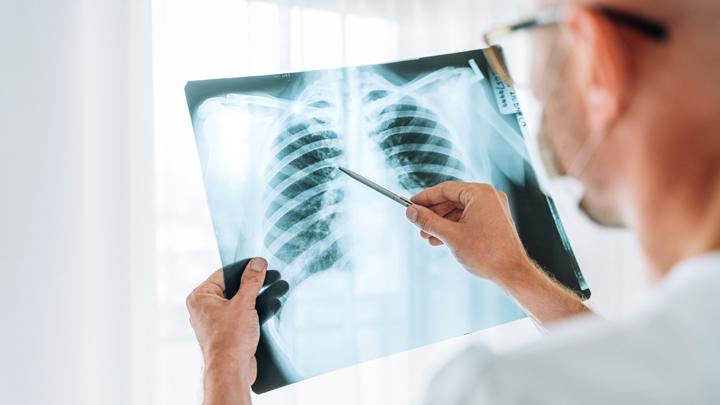 Japan Enforces TB Screening for Vietnamese Citizens; Indonesia Is Next in Line
