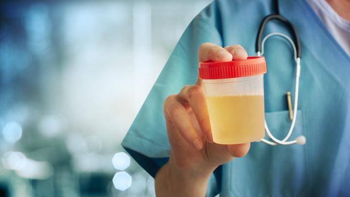 The Meaning of Changes in Urine Color and Smell