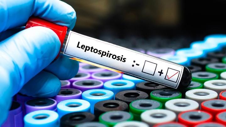 Ilustrasi Leptospirosis. Shutterstock