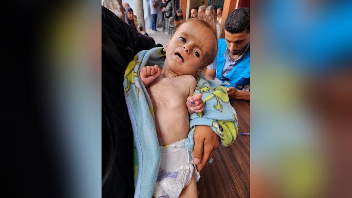100,000 Gaza Children Face Mass Starvation Deaths