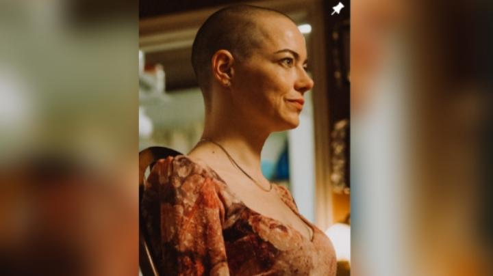 Emma Stone Mengaku Sempat Panik Ngebotakin Rambut