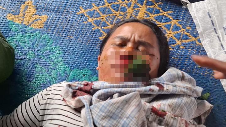 AMAN: Toba Pulp Lestari Workers Assault Indigenous Residents Guarding Ancestral Land