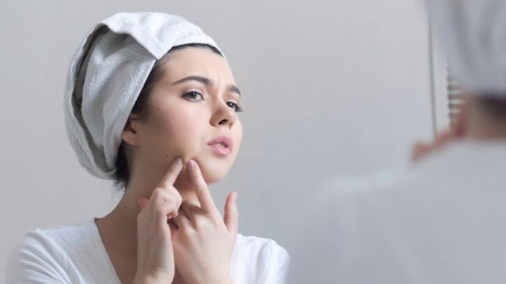 Sederet Makanan Ini Bisa Bikin Jerawat, Yuk Bisa Yuk Dikurangi!