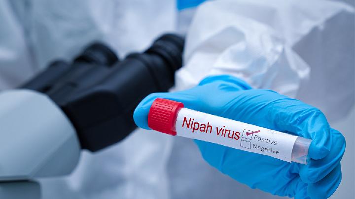 Virus Nipah Terdeteksi di Kelelawar Indonesia