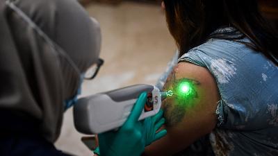 Free Tattoo Removal Program during Ramadan