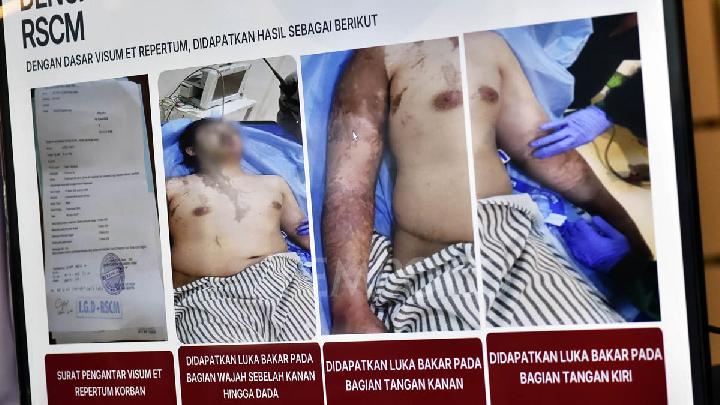 Police Identify Four Suspects in Acid Attack on Andrie Yunus