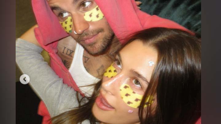 Hailey Bieber dan Justin Bieber Siap Rilis Pimple Patch Unik dan Playful di Coachella 2026