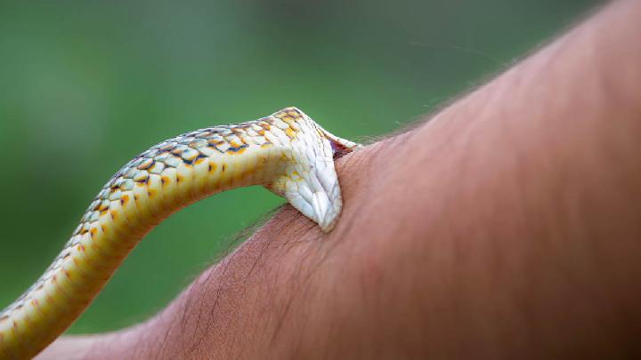 Cerita 202 Kali Digigit Ular Berbisa dan Kini Menjadi Kebal