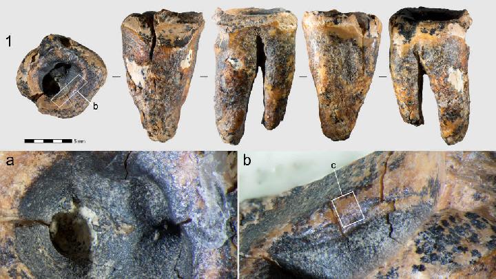 Fosil 60 Ribu Tahun Ungkap Perawatan Gigi Neanderthal